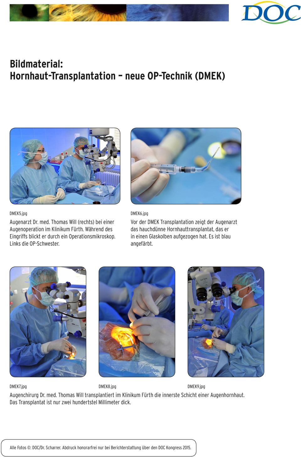 jpg Vor der DMEK Transplantation zeigt der Augenarzt das hauchdünne Hornhauttransplantat, das er in einen Glaskolben aufgezogen hat.