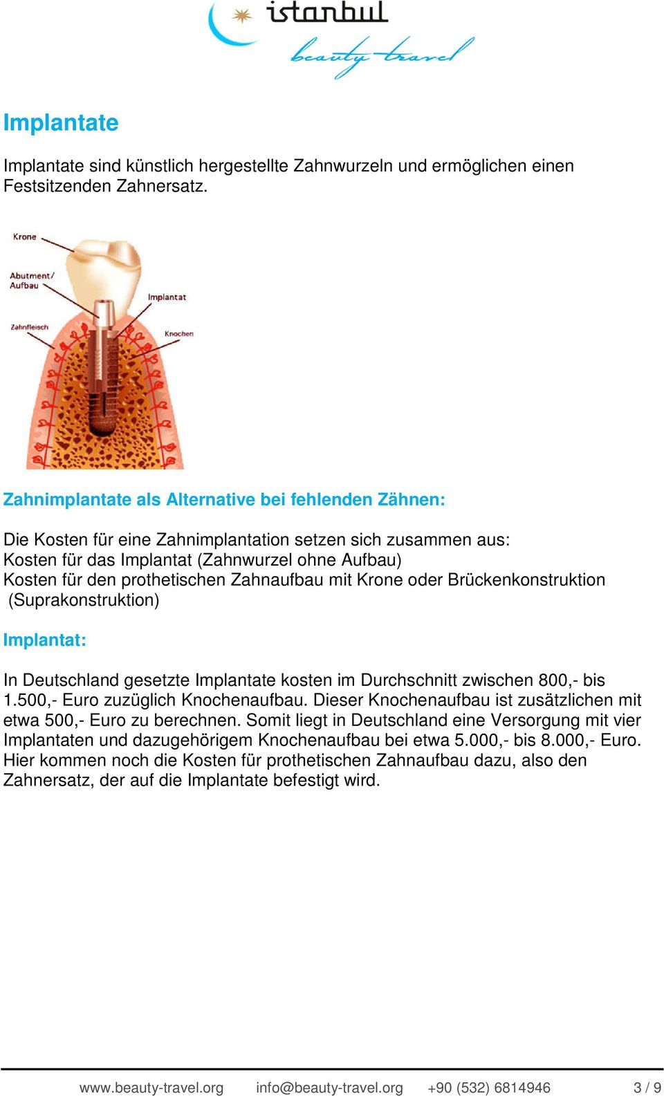 Zahnaufbau mit Krone oder Brückenkonstruktion (Suprakonstruktion) Implantat: In Deutschland gesetzte Implantate kosten im Durchschnitt zwischen 800,- bis 1.500,- Euro zuzüglich Knochenaufbau.