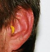 Gehörschutzstöpsel Schaumstoffstöpsel