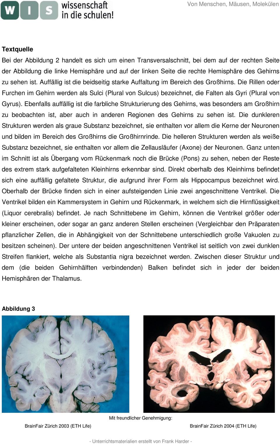 Die Rillen oder Furchen im Gehirn werden als Sulci (Plural von Sulcus) bezeichnet, die Falten als Gyri (Plural von Gyrus).