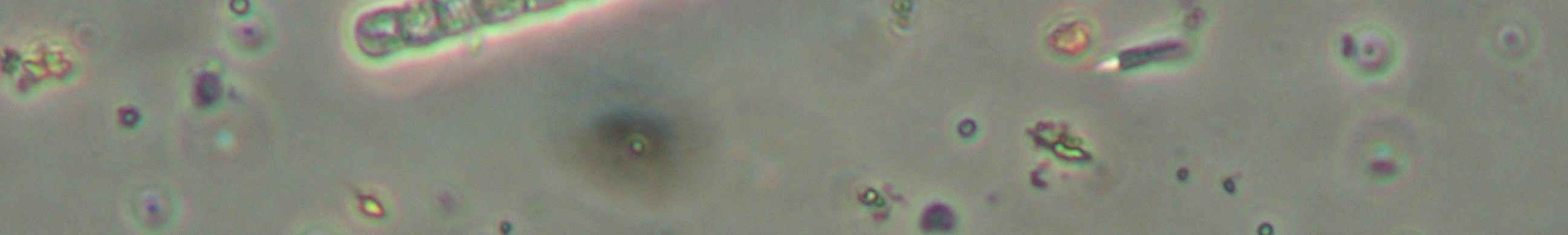 5. Beispiele von mikroskopischen Aufnahmen verschiedener toxinbildender Blaualgen Anabaena lemmermannii Microcystis aeruginosa Müllroser See vom 04.06.2007 W.