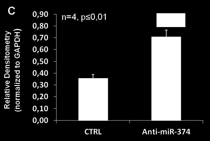 Ergebnisse Abbildung 34: Expression von Nampt nach knock-down mit anti-mirna-374 in humanen Koronarendothelzellen Knock-down von mirna-374 in HCAECs durch reverse