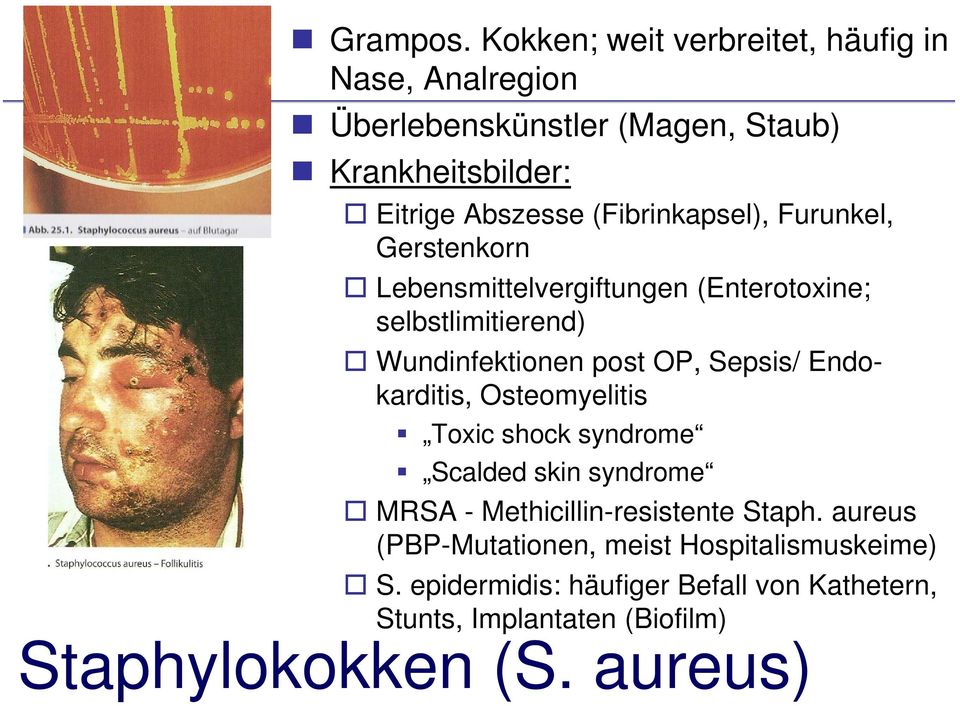 (Fibrinkapsel), Furunkel, Gerstenkorn Lebensmittelvergiftungen (Enterotoxine; selbstlimitierend) Wundinfektionen post OP, Sepsis/