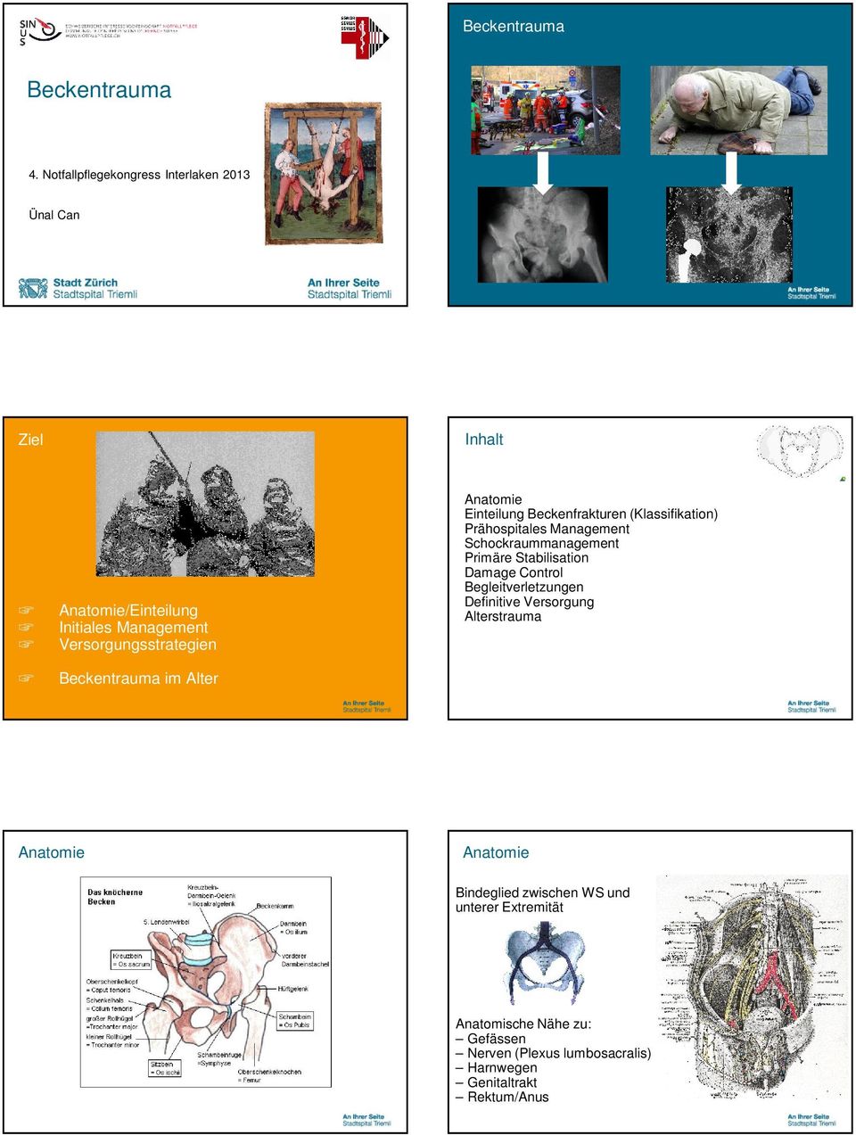 Beckentrauma im Alter Anatomie Einteilung Beckenfrakturen (Klassifikation) Prähospitales Management Schockraummanagement Primäre