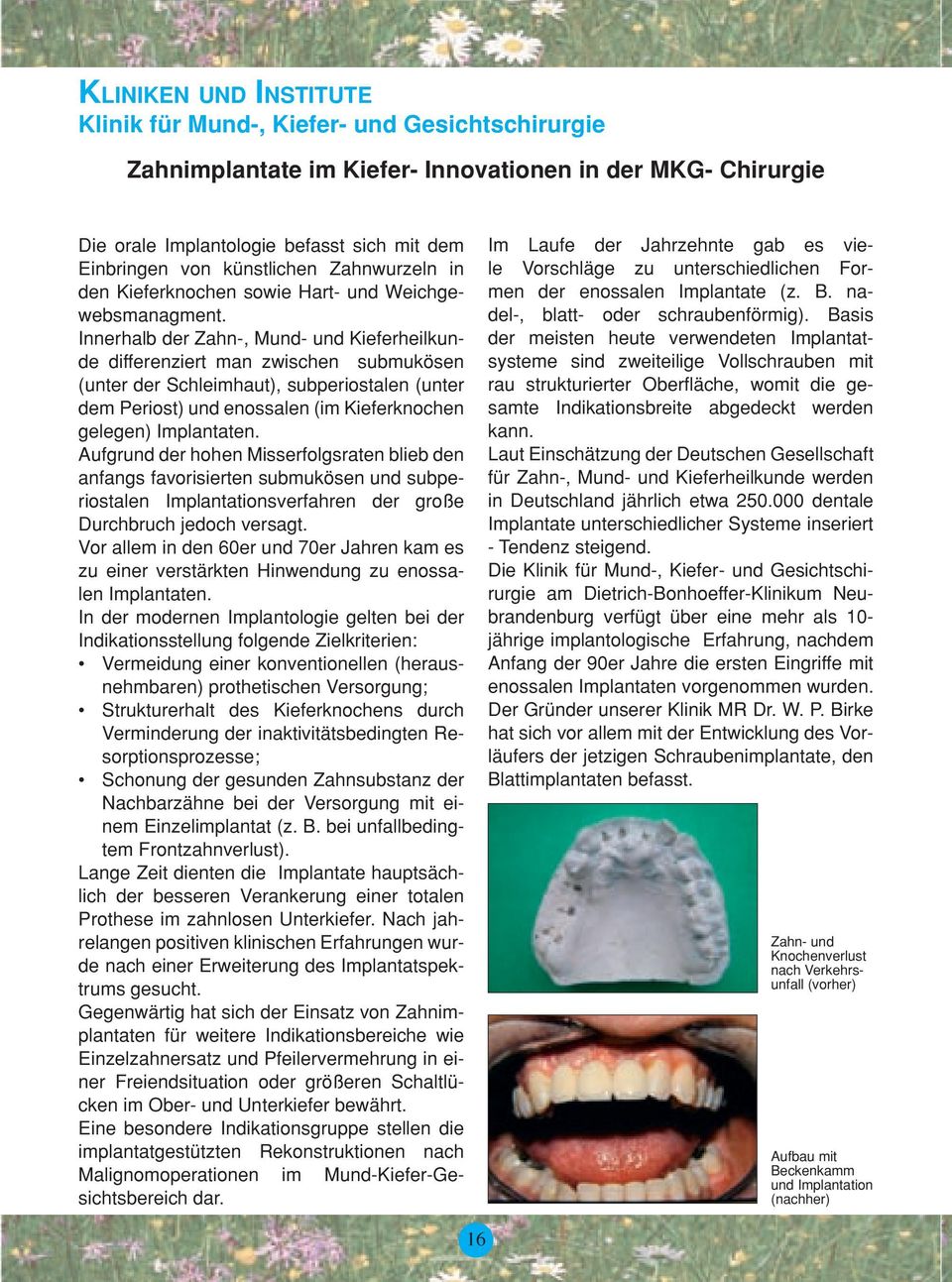 Innerhalb der Zahn-, Mund- und Kieferheilkunde differenziert man zwischen submukösen (unter der Schleimhaut), subperiostalen (unter dem Periost) und enossalen (im Kieferknochen gelegen) Implantaten.