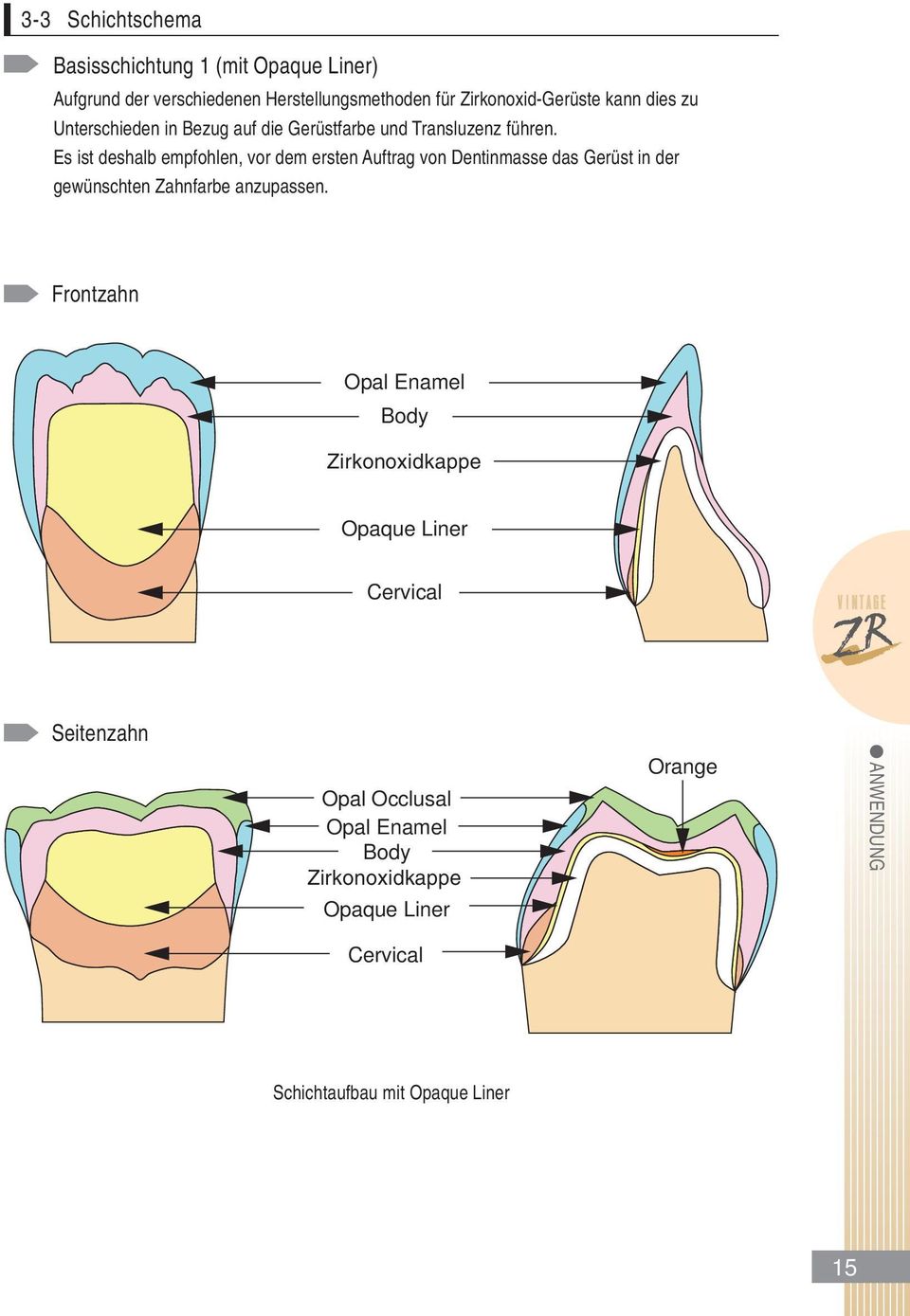 Es ist deshalb empfohlen, vor dem ersten Auftrag von Dentinmasse das Gerüst in der gewünschten Zahnfarbe anzupassen.