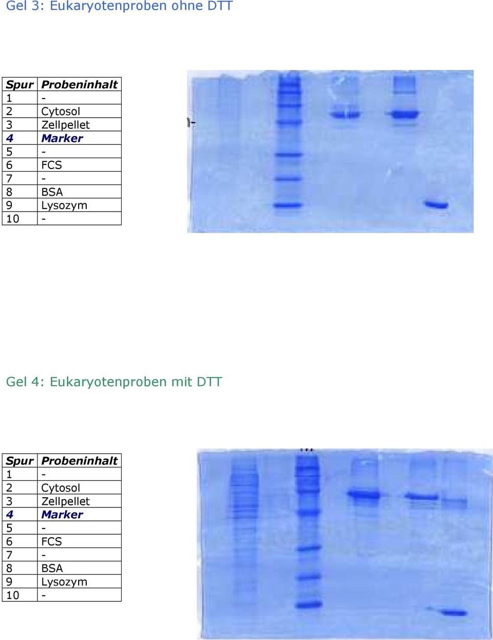10 - Gel 4: Eukaryotenproben mit DTT Spur Probeninhalt