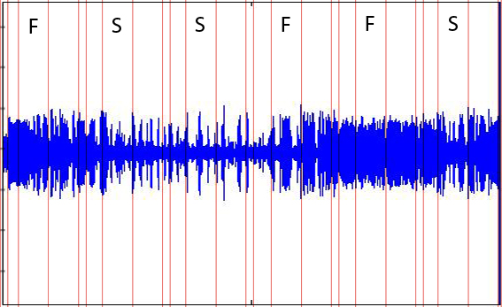 Aufnahme der Alpha-Welle (8-12 Hz) bei einem Probanden (F =