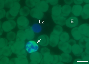 Abbildung 4.78: Neutrophiler Granulozyt und Lymphozyt, PHA-L-FITC (Hund, wbl. 2Jahre); das Zytoplasma und die Zellmembran des Neutrophilen (Pfeil) sind deutlich positiv.