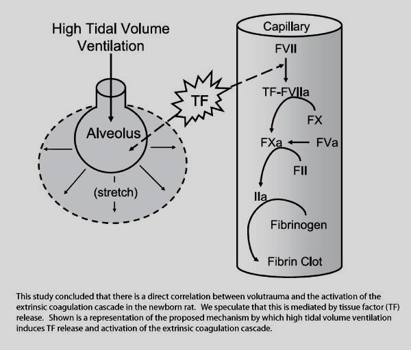 Beatmungsstrategien beim ARDS Low Tidal Volume Ventilation FRAGE: Tidalvolumen von