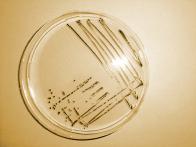 Lebensmittel mikrobiologische Ringversuche Die Mikrobiologischen Ringversuche des DRRRs zeichnen sich zum einen dadurch aus, dass ausschließlich mit vegetativen Mikroorganismen und keinen