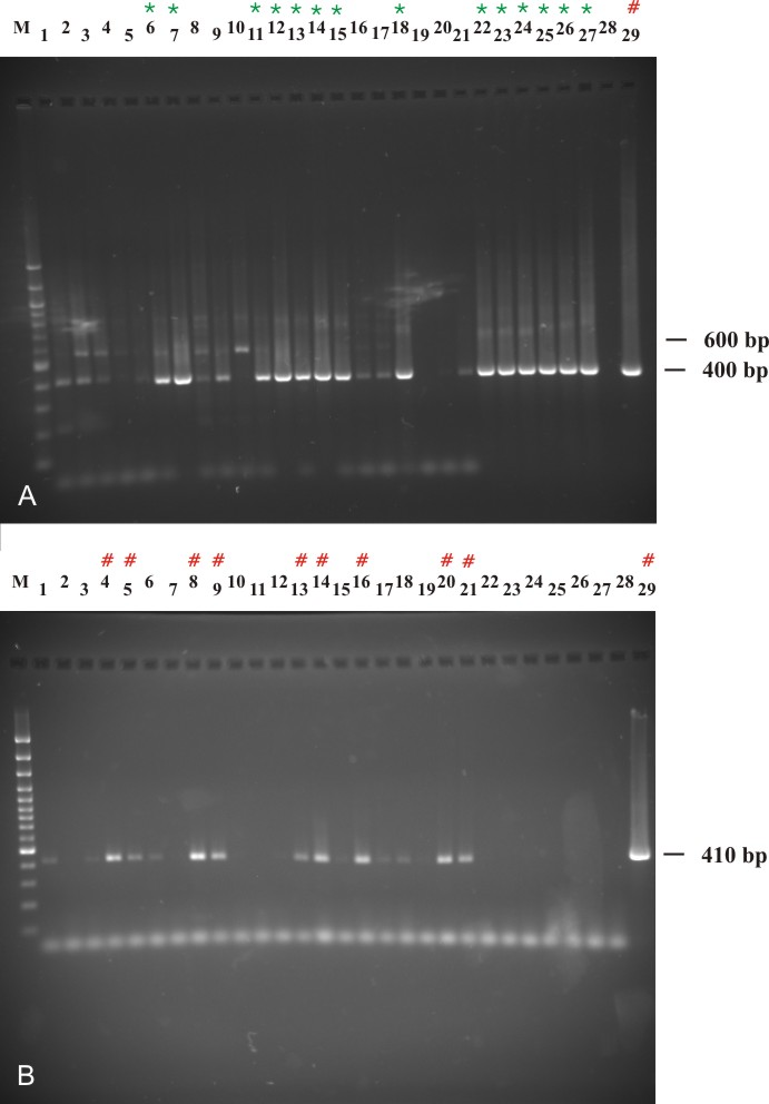 4. Ergebnisse 65 den beiden Experimenten. Proben, bei denen mit einem Primerpaar nur schwache Amplifikate erzeugt wurden, zeigten in der RT-PCR mit dem jeweils anderen Primerpaar stärkere Banden (vgl.