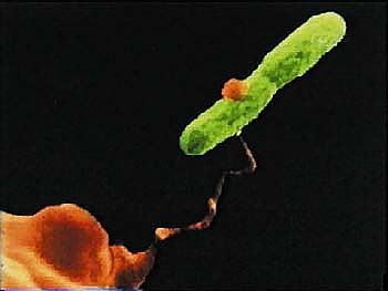 Stichwort Legionellen Legionella Pneumophila - Auslöser der Legionärskrankheit.