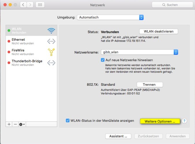 Apple Geräte MacBook Netzwerk Einstellungen Falls das WLAN nicht funktioniert, über das