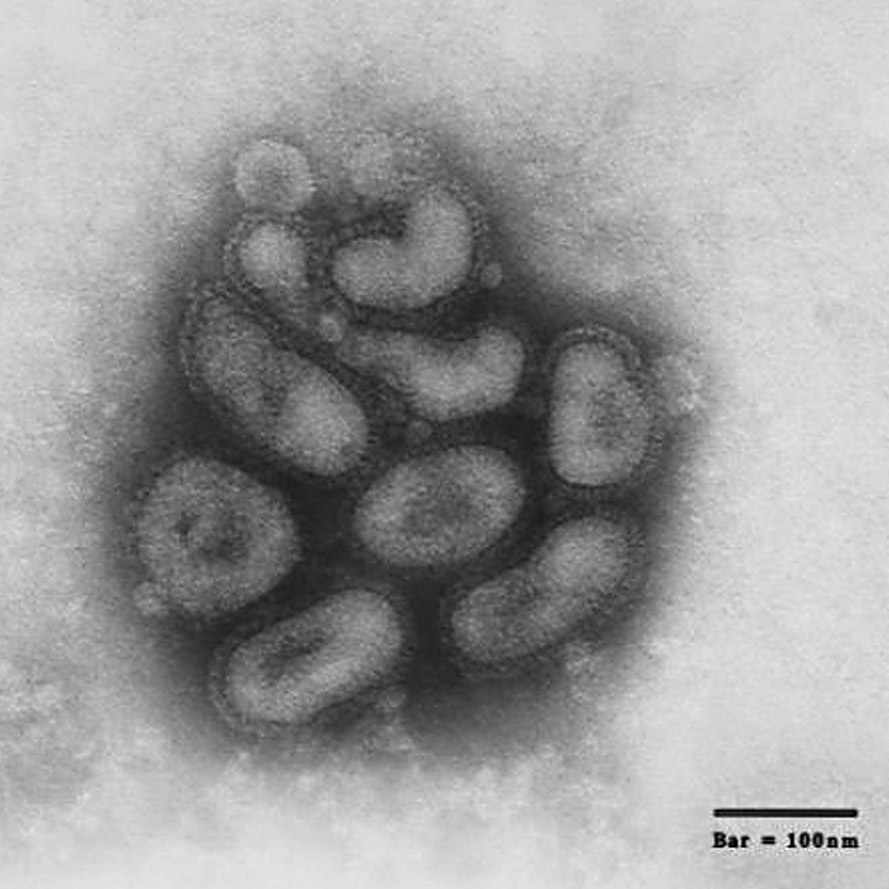 8 BioFokus Nr. 71/2005 WHO-PANDEMIEPHASEN Interpandemische Phase: Phase 1: Keine neuen Influenza Virus-Subtypen beim Menschen entdeckt.