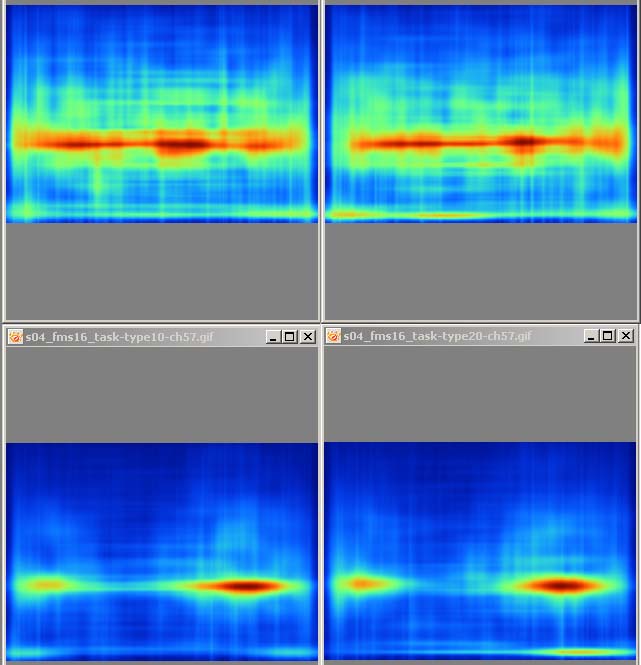 Passives Zuhören 10 Hz Frequenz