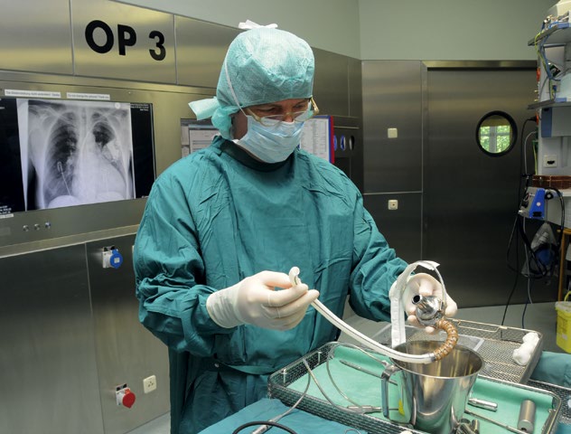 Management & Krankenhaus 12/2013 Medizin & Technik 7 Assist Devices retten zunehmend Patienten 512 Menschen leben zurzeit in Deutschland mit einem Kunstherzen.