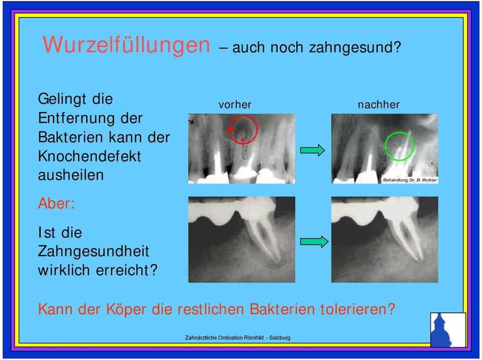 Knochendefekt ausheilen Aber: Ist die Zahngesundheit