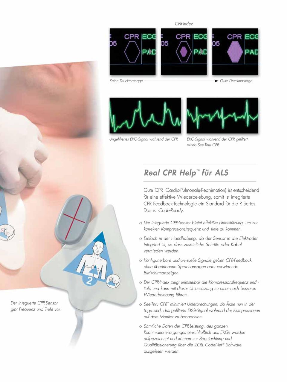 o Der integrierte CPR-Sensor bietet effektive Unterstützung, um zur korrekten Kompressionsfrequenz und -tiefe zu kommen.