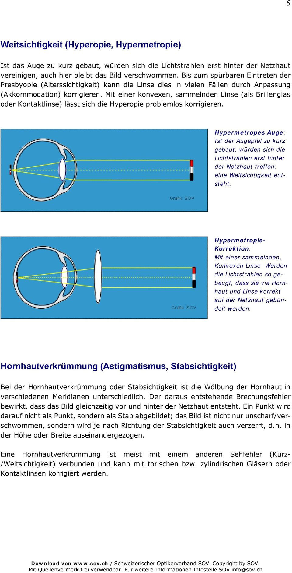 Mit einer konvexen, sammelnden Linse (als Brillenglas oder Kontaktlinse) lässt sich die Hyperopie problemlos korrigieren.