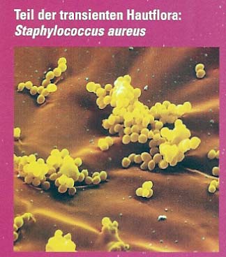 Staphylococcus aureus grampositive Kokken in Haufen oder Trauben angeordnet bildet keine Sporen, hohe Widerstandsfähigkeit