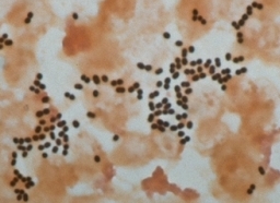 Bakt. Labor Leoben Respirationstrakt Resistenzbericht 2004 Streptococcus pneumoniae Unsere Isolate stammen überwiegend aus dem Respirationstrakt, vereinzelt auch von anderen Lokalisationen (5x