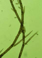 Systematisch-taxonomische Klassifizierung 3.3 Braunalgen (Fucophyceae, Phaeophyceae) Die Klasse der Braunalgen umfassen morphologisch sehr unterschiedlich gestaltete mehrzellige Organismen (Abb. 9).