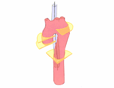Anlotungen der thorakalen Aorta 1.