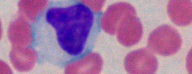 Virusinfektion: Zell-, Gewebe- und Organotropie Virushepatitis Immer Leber, selten Lymphknoten (10%) Ebstein-Barr-Virus (EBV) Infektion