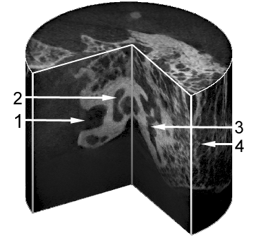 Abbildung 1.2.2 Verbildlichung eines DVT-gescannten, zylindrischen Volumens, das ein Felsenbein umfasst. Der Anschaulichkeit wegen ist ein Teil herausgeschnitten.