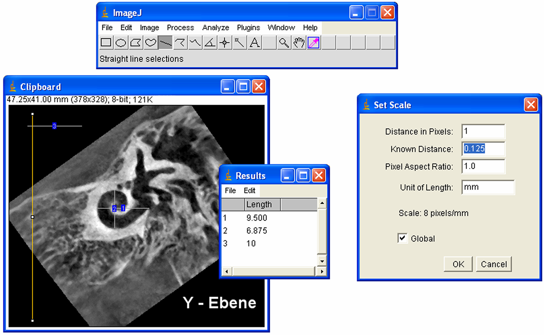 Bildanalysesoftware ImageJ Version 1.32j (National Insitute of Health, USA) durchgeführt. Die Messskalierung betrug 0.125 mm pro Pixel.