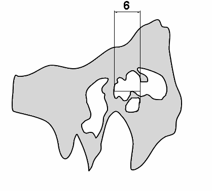 Abbildung 2.7.2 Vermessung im Bereich der Cochlea. Z-Ebene. Schema: Messstrecken. Abbildung 2.7.3 Vermessung im Bereich der Cochlea.