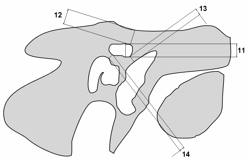 Abbildung 2.7.7 Schema zu Vermessungen im Bereich des Knochenkanales am äußeren Knie des N. Facialis. Z-Ebene. Beispielhaft für die linke Seite.