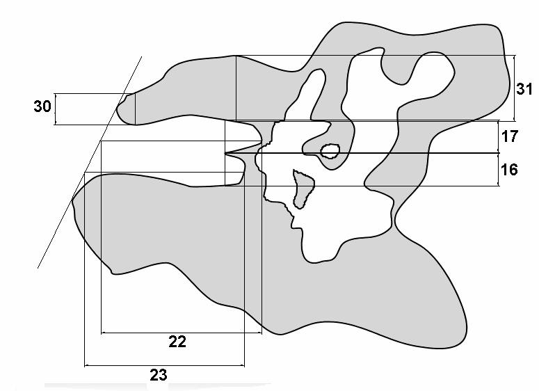 Abbildung 2.7.9 Schema 1 zu Vermessungen im Bereich des inneren Gehörganges (hier beispielhaft: links). Y Ebene.