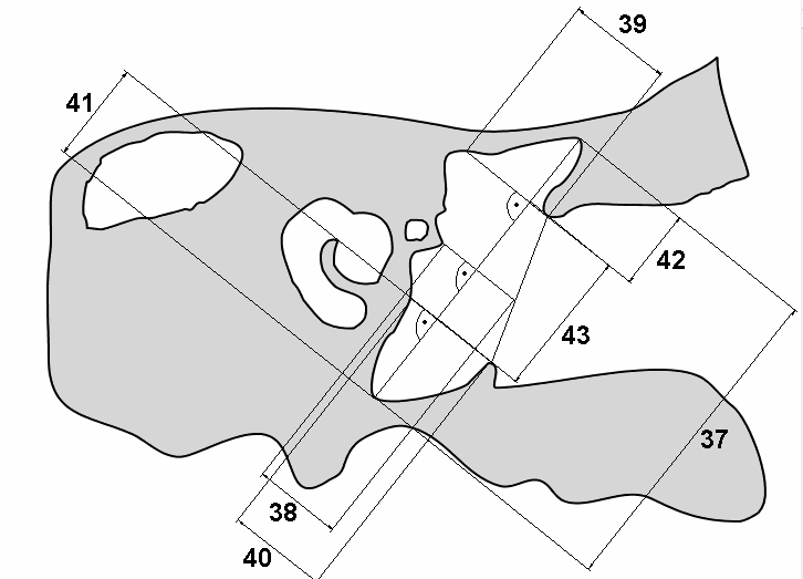 Abbildung 2.7.14 Schema 1 bzgl. der Vermessungen im Bereich der Paukenhöhle. Y- Ebene, links.