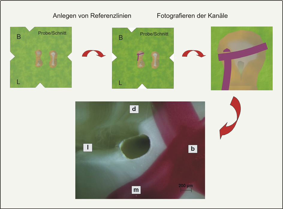 4 Material und Methoden 27 Wurzelkanalquerschnittsfotos: Für die Querschnittsanalyse der Proben wurden nahe der Wurzelkanäle Referenzlinien mit Nagellack (Betrix, Frankfurt/Main, Deutschland)