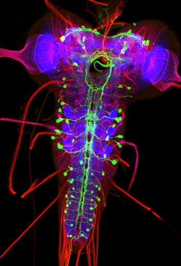 Humanmedizinische Forschung in Drosophila Bei der Arbeit mit Drosophila liegt in vielen Fällen ein besonderer Fokus auf humanmedizinischen Aspekten.