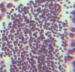 Zur Ermittlung der Gonadenreife wurden unterschiedliche Reifungsstufen der Keimzellen unterschieden. Diese Differenzierungen sind Tab.