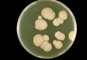 Auswahl der Keime Staphylococcus aureus, ATCC 6538 gram + fakultativ anaerob Testung mit aeroben u.