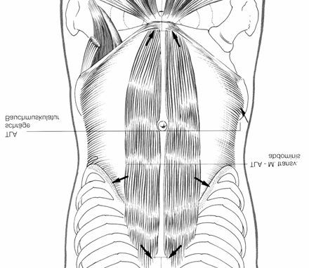 TLA M. rectus abdominis TP in den verschiedenen Abschnitten imitieren Organbeschwerden, z.b. Appendix, Cor, Ausstrahlungen auch in den Rücken.Verstärkung der Dysmenorrhoe.