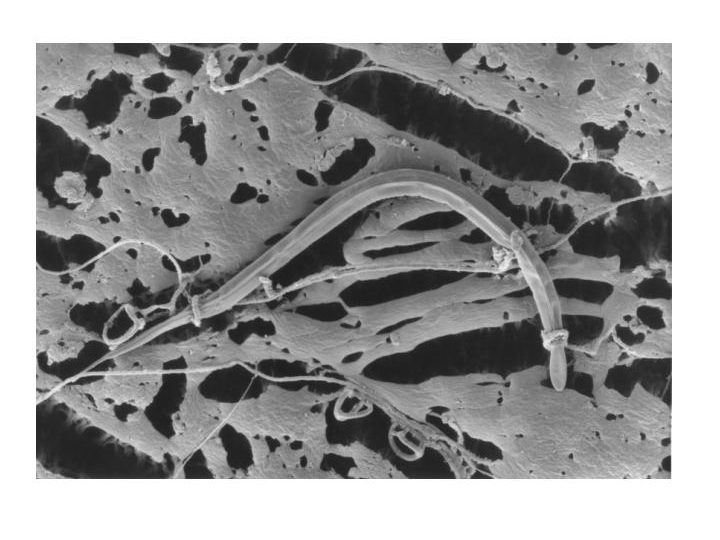 Abb. 3: Infektiöse Larve von Magen-Darm-Nematoden, fixiert durch Hyphen von Duddingtonia flagrans (Foto Hertzberg) In einzelnen Versuchen auf Jungrinderweiden führte dieser Prozess zu einer etwa