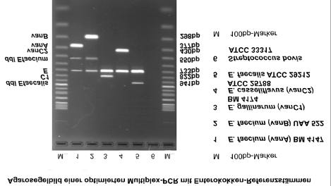 BfR-Wissenschaft 67 Abbildung 66: PCR-Gelbild der optimierten Multiplex-PCR für Enterokokken-Referenzstämme und einer Negativ-Kontrolle (Streptococcus bovis ATCC 33317) Bei der Anwendung aller