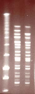 Ergebnisse 72 1 2 3 kbp 291 242,5 194 145 97 48,5 Abb. 21: Pulsfeldgelelektrophorese mit SmaI gespaltener chromosomaler DNS des Stammpaares E. faecium ATCC 6569.