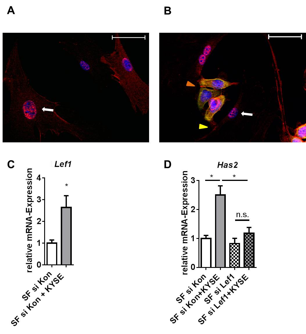 3 Ergebnisse Abbildung 17. Beteiligung von β-catenin/lef1-signalwegen an der Hyaluronsäuresynthase 2- Induktion. A, Immunzytochemische Färbung von β-catenin (rot) in Monokultur.