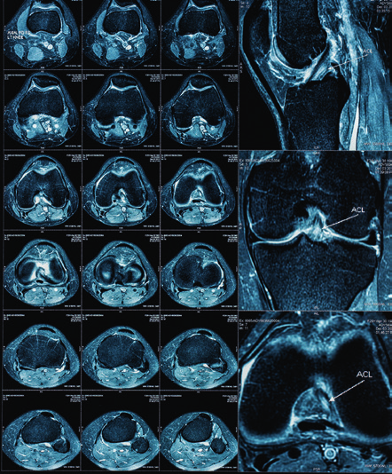 Diagnose: Experten notwendig Röntgen Auf dem Röntgenbild werden Knochen sichtbar.