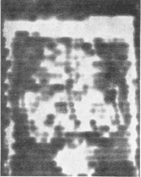Hyperphonographie Abb. 2. Hyperphonogramm eines Gehirnpräparates eines jungen Rindes (1940) in Formol gehärtet.