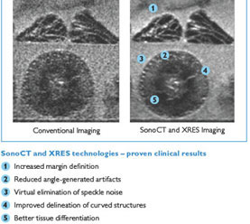 Rausch- und Artefaktverminderung durch Sono CT (in der Ebene; 3x, 5x,7x,9x) XRES