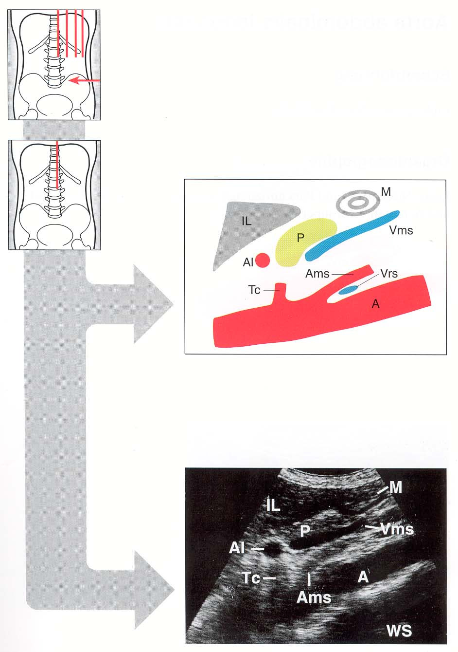Aorta abdominalis längs A = Aorta TC = Truncus coeliacus M = Magen AL = Arteria Lienalis P =