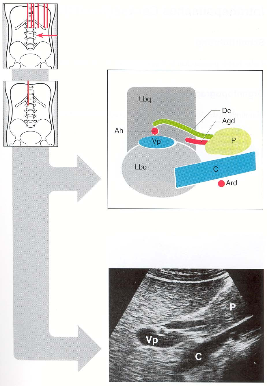 Anatomische Leberpforte P Ah DC Agd Lbc Ard = Porta = Arteria hepatica =