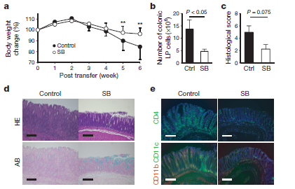 SCFA vermitteln die stimulatorische Wirkung von Clostridien auf T Reg SCFAs beeinflussen die Bildung von regulatorischen T Zellen